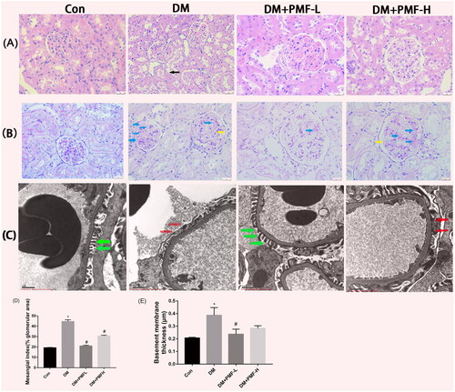Figure 7. Effects of PMF on the pathological changes in the kidney of rats. (A) H&E staining. The black arrow indicates the loss of brush border. (B) PAS staining of rat kidney. Original magnification, ×400. Blue arrows indicate mesangial matrix accumulation; Yellow arrows indicate GBM thickening. (C) Representative ultrastructure of GBM was demonstrated by TEM. Original magnification, ×10,000. Red arrows demonstrate foot process effacement. Green arrows indicate well-aligned foot processes. (D) The mesangial matrix index was calculated by Image J software. (E) Quantitative analysis of GBM thickness (µm). *p < 0.05 vs. control, #p < 0.05 vs. DM. Con: nondiabetic rats without treatment; DM: diabetic rats treated with saline; DM + PMF-L: diabetic rats treated with 5 mg/kg PMF; DM + PMF-H: diabetic rats treated with 25 mg/kg PMF.