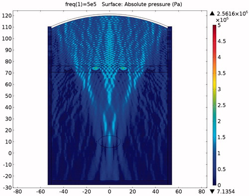 Figure 18. Sound field simulation in the absence of protection.