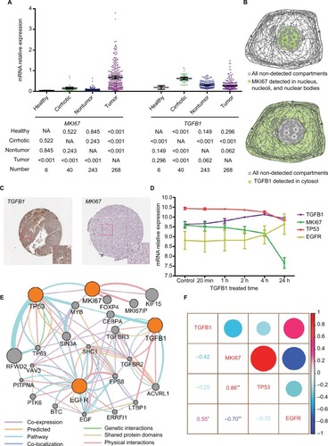 Figure 4 The expression of MKI67 and TGFB1 in tissues and cell components and the relation between MKI67 and TGFB1.Notes: (A) The MKI67 and TGFB1 expression levels in different types of liver tissue were analyzed in GEO dataset (GEO accession: GSE25097). The values below the graph were calculated using an LSD-t test after a one-way ANOVA. (B) Model graphic of MKI67 and TGFB1 distributed in cell components. (C) Immunohistochemistry staining of MKI67 and TGFB1 in liver cancer tissue. (D) Dynamically changing gene expression in HepG2 cells upon stimulation with 1 ng/mL TGFB1 over time. (E) Pathway analysis of MKI67, TGFB1, TP53, and EGFR in GeneMANIA. (F) Correlation analysis of gene expression in HepG2 cells upon stimulation with 1 ng/mL TGFB1. *represents p<0.05; **represents p<0.01.Abbreviations: ANOVA, analysis of variance; GEO, Gene Expression Omnibus; LSD, Least Significant Difference; NA, not available.