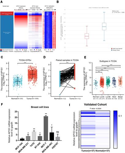 Figure 1 The expression level of AP1S1 in breast cancer. (A) The heat maps of AP1S1 mRNA expression, exon expression and methylation in primary breast cancer and corresponding normal tissues from UCSC Xena. (B) The AP1S1 expression level of no paired breast cancer patients in TCGA dataset. (C) AP1S1 expression of no paired breast cancer patients in TCGA+GTEx dataset. (D) AP1S1 expression level of paired breast cancer patients in TCGA dataset. (E) AP1S1 expression of different breast cancer subtypes in TCGA dataset. (F) AP1S1 expression in different breast cell lines. (I) AP1S1 expression in breast cancer in validated cohort. ns: no significance, * P<0.05, **p<0.01, ***p<0.001.