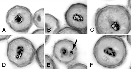 Figure 4. Pattern of the macronuclear chromatin structure dynamics, shown by optical microscopic images of excysting cells of Colpoda inflata. Samples derived from 1-year-old cysts of a senescent culture, examined 24 h after the excystment induction. During chromatin decondensation, the highly condensed and compact mass (A) becomes first irregular in shape (B); then undergoes fragmentation (C,D); finally, part of the chromatin unable to decondense (arrow) is extruded into the cytoplasm (E), where it is digested (F). Black refers to very condensed chromatin. Chromatin gradual decondensation is represented by the decreasing intensity of the shade of grey (modified from European Journal of Protistology, Vol. 37, Issue 3, Maria Giovanna Chessa, Lorenzo Gallus, Luca Tiano, Francesca Trielli, Maria Umberta Delmonte Corrado, Variations in macronuclear chromatin structure and chromatin extrusion in excystment from resting cysts of Colpoda inflata, pp. 281–290, Copyright (2001), with permission from Elsevier).