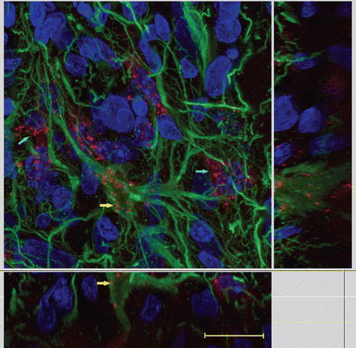 Figure 5.  Co-localization of intravenously injected MAbE2Cx43 conjugated with Alexa Fluor 660 (red) and GFAP-reactive astrocytes (green). Yellow arrows show GFAP- and Сх43-positive cells; blue arrows show GFAP-negative Cx43-positive cells. Scanning laser confocal microscopy. Scale bar, 10 μm.