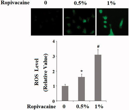 Figure 4. Ropivacaine-induced generation of intracellular ROS. Human SH-SY5Y neuronal cells were treated with 0.5% and 1% ropivacaine for 72 h. Intracellular ROS was determined by DCFH-DA assay (*, #, P < .01 vs. previous column group).