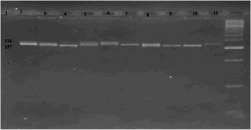 Figure 1. RFLP analysis of FcγRIIa polymorphisms. Lane 1: DNA marker (50–1000 bps). Lanes 5, 7, 8, 10, 11: heterozygous HR (316 bp and 337 bp). Lanes 3, 4, 6, 9: homozygous RR (316 bp). Lane 2: Wild type HH (337 bp).