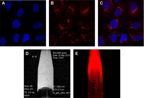 Figure 3 (A–C) Feasibility of cell transfection in A549 lung cancer cells in fluorescent imaging mode using gadolinium-conjugated silica nanoparticles (0.2 mg/mL).Notes: (A) Nuclei stained by 4,6-diamidino-2-phenylindole (blue), (B) dual imaging silica nanoparticles represents red fluorescence (rhodamine isothiocyanate dye). (C) Merged fluorescence microscopic image of dual imaging silica nanoparticles transfected in A549 lung cancer cells. Gadolinium-conjugated silica nanoparticles in colloidal solution using T1-weighted magnetic resonance imaging (D) and fluorescent imaging mode (E).