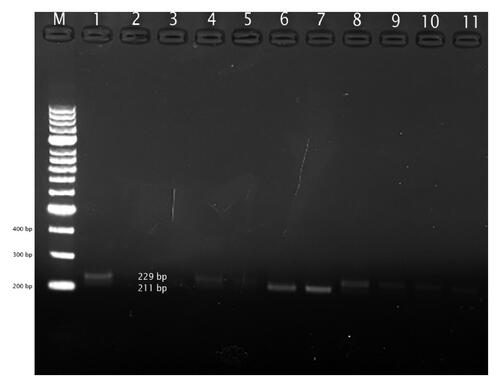 VEGFA VNTR variant in agarose gel (%1,5) electrophoresis.Notes: Lane M = Marker;- Lanes 10,11= II homozygous allele (229 bp);- Lanes 1,4,5,8,9= ID heterozygous allele (211 and 229 bp);- Lane 6,7= DD homozygous allele (211 bp);- Lane 2,3= no template control.