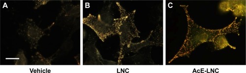 Figure 1 Uptake of LNC and AcE-LNC by melanoma cells.Notes: B16F10 (5×105 cells) were cultured in the presence of vehicle (culture medium) (A), LNC (9×109 particles/mL) (B), or AcE-LNC (30 of AcE; 9×109 particles/mL) (C) and 2 h later were analyzed by enhanced dark-field CytoViva® microscopy. Scale bar represents 10 µm. AcE-LNC, LNC loaded with AcE.Abbreviations: AcE, acetyleugenol; LNC, lipid-core nanocapsule.