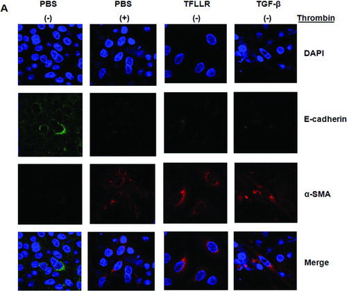 FIGURE 6  A549 alveolar epithelial-to-myofibroblast transition in vitro. Immunoreactivity for both α-SMA and E-cadherin was assessed by immunofluorescence after stimulation with thrombin, TFLLR, and TGF-β. (A) Dual immunocytochemical staining showed that thrombin, TFLLR, and TGF-β decreased cadherin (green) and increased α-SMA (red) expression in cultured A549 cells. (B) Dual immunocytochemical staining showed that PAR-1 siRNA or pretreatment with argatroban, GÖ6976, rottlerin, or PKCε antagonist peptide inhibited epithelial-to-mesenchymal transition induced by thrombin. All recovered cadherin (green) expression and inhibited α-SMA expression (red) induced by thrombin in cultured A549 cells. Nuclei were visualized by 4′,6-diamidino-2-phenylindole staining (blue). Original magnification, ×1000. All experiments were performed three times, and representative images are presented. Merge indicates sum of DAPI, E-cadherin, and α-SMA. (C) Typical microphotographs of A549 cells stimulated with the thrombin. Addition of thrombin especially at a 2.0 U/mL concentration for 72 hours changed the polygonal A549 cells to a more elongated mesenchymal phenotypes. Original magnification, ×400. (Continued)