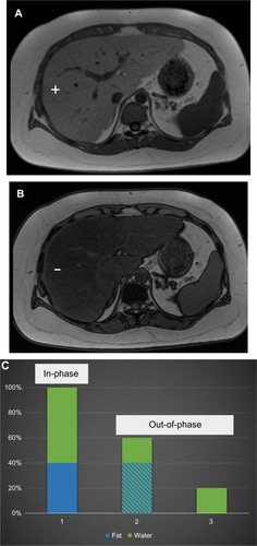 Figure 11 MRI of fatty liver disease.