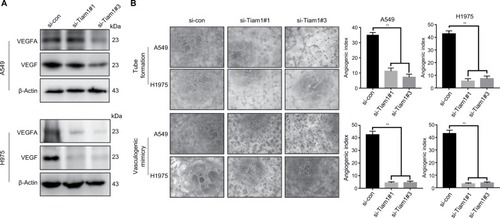 Figure 6 Tiam1 depletion reduces angiogenesis and cancer cell VM capacities.Notes: (A) Relative expression levels of VEGF and VEGFA in A549 and H1975 cells with si-control or si-Tiam1, respectively. (B) Endothelial tube formation assay was performed with HUVECs incubated in culture medium of A549 and H1975 cancer cells 48 hours after transfection with the si-control and si-Tiam1. The VM assay was performed with A549 and H1975 cancer cells with si-control or si-Tiam1, respectively (original magnification, 100×).Abbreviations: HUVECs, human umbilical vein endothelial cells; VM, vasculogenic mimicry.