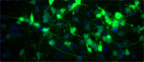 Figure 1. Retrovirally infected neural progenitor cells identified by green fluorescent protein (GFP) expression. Blue: nuclei; Green: GFP.