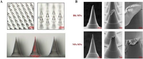 Figure 3. Morphology (A) and scanning electron microscope (SEM) morphology of nanoparticles-encapsulated polymeric microneedles (NPs-MNs) (B).