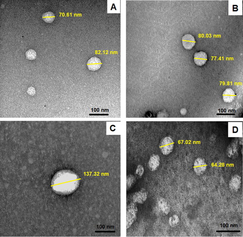 Figure 3. TEM image showing the morphology of uncoated loaded bilosomes (A), uncoated unloaded bilosomes (B), LF-coated loaded bilosomes (C), and LF-coated unloaded bilosomes (D).