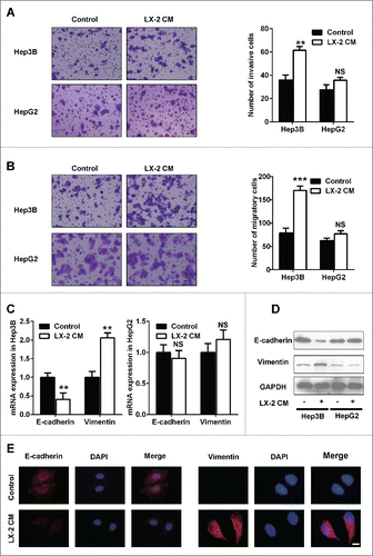 Figure 1. LX-2 cells promoted invasion and migration of Hep3B cells, but not HepG2 cells. A. Invasiveness of cells was determined using the Transwell assay. Hep3B and HepG2 cells treated with LX-2 cells CM were plated in the upper chamber of the Transwell and allowed to grow for 24 hours in serum-free medium, 5% fetal bovine serum was placed in the lower chamber. The number of cells that invaded through the Matrigel was counted in 10 fields under the ×20 objective lens, and is shown as the mean ± standard deviation. Scale bar = 100μm. **P < 0.01, NS, no significant. B. Migration of cells was determined using the Transwell assay. Hep3B and HepG2 cells treated with LX-2 cells CM were plated in the upper chamber of the Transwell and allowed to grow for 24 hours in serum-free medium, 5% fetal bovine serum was placed in the lower chamber. The number of cells that migrated was counted in 10 fields under the ×20 objective lens, and is shown as the mean ± standard deviation. Scale bar = 100μm. ***P < 0.001, NS, no significant. C. Real-time PCR was used to detect E-cadherin and Vimentin expression in Hep3B and HepG2 cells treated with LX-2 cells CM, GAPDH was used as an internal reference. **P < 0.01, NS, no significant. D. Western-blot was used to detect E-cadherin and Vimentin expression in Hep3B and HepG2 cells treated with LX-2 cells CM, GAPDH was used as an internal reference. E. Immunofluoresence was used to evaluate E-cadherin and Vimentin expression in Hep3B and HepG2 cells treated with LX-2 cells CM. Scale bar = 100 μm.