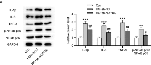 Figure 4. Effects of NUP160 depletion on inflammatory response in HG-treated NRK-52E cells. (a) The protein levels of IL-1β, IL-6, and TNF-α in HG-treated NRK-52E cells transfected with sh-NUP160 were examined by western blot. **P < 0.01, ***P < 0.001 vs. the control group; #P < 0.05, ##P < 0.01 vs. the HG+sh-NC group