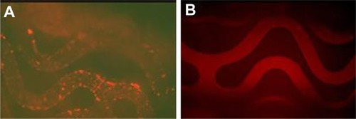 Figure 4 Representative fluorescence microscopy images of immobilization of rhodamine-labeled DNA/anti-DNAantibody/cationic lipid micelles on polyallylamine bisphosphonate-modified stents. (A)Chemically linked on the stents; (B) physically adsorbed on the control stents(fluorescein isothiocyanate, ×100).