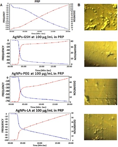 Figure 6 Effects of AgNPs on platelet aggregation as measured by QCM-D. Perfusion of sensor crystals with PRP in the presence of AgNPs-GSH, AgNPs-PEG, or AgNPs-LA (100 µg/mL) inhibited platelet aggregation.Notes: (A) Representative tracings from the third overtone recorded by the device in the presence or absence of AgNPs (100 µg/mL) on frequency (blue line, left axis) and dissipation (red line, right axis). (B) Representative micrographs of the surface of sensors as viewed by phase contrast microscopy showing decreased accumulation of platelet aggregates in the presence of AgNPs.Abbreviations: AgNPs, silver nanoparticles; QCM-D, quartz crystal microbalance with dissipation; PRP, platelet-rich plasma; GSH, glutathione; PEG, polyethylene glycol; LA, lipoic acid.