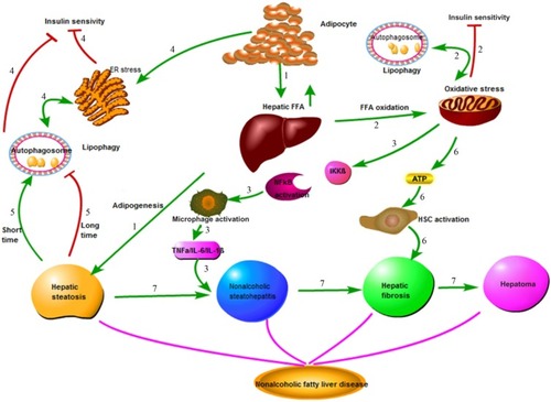 Figure 1 Pathophysiology of nonalcoholic fatty liver disease (NAFLD).