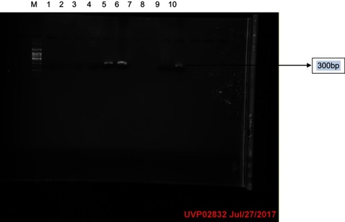 Plate 2 Gel electrophoresis result of the nested PCR of blood samples showing the Pfcrt genes.