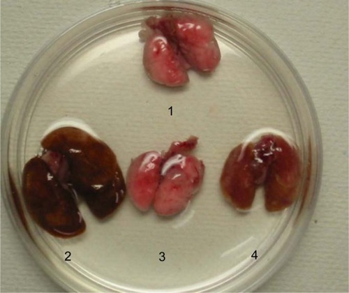 Figure 2 Macroscopic lung findings.