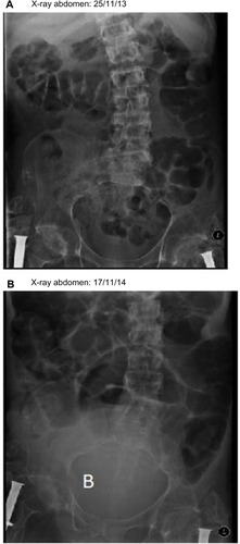 Figure 1 Images of urinary tract.
