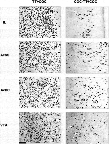 Figure 3. Representative photomicrographs of Fos protein expression in the IL, AcbS, AcbC, and VTA of rats from all experimental groups at 20× magnification, where Fos protein expression was visible as dark ovals (highlighted by arrows). Scale bar = 100 μm.