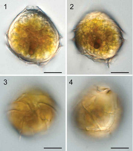 Figs 1–4. Light micrographs of live cysts of Bysmatrum subsalsum from France. Fig. 1. Ventral view in mid-focus showing numerous granules, a red accumulation body and the apical stalk. Fig. 2. Dorsal view showing numerous granules and a red accumulation body. Fig. 3. Ventral view showing the cingulum displacement. Fig. 4. Dorsal view showing the plates. Scale = 10 μm.