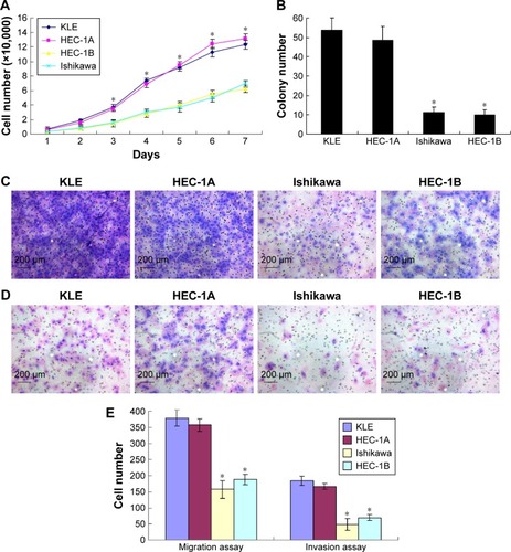 Figure 3 Different proliferation, migration and invasion abilities of four types of human endometrial cancer cell lines.