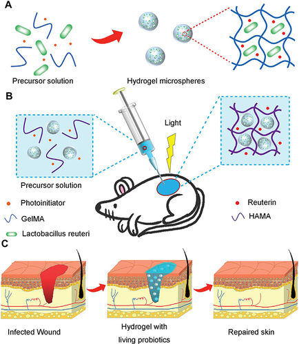 Figure 6 Schematic illustration of the preparation and acceleration of wound healing while using living probiotic hydrogels. (A) The process of encapsulating bacteria in microspheres. (B) Covalent cross-linking within light-irradiated microspheres containing active probiotics. (C) Procedure for treating wounds with live bacterial hydrogel. Reprinted from Ming Z, Han L, Bao M, et al. Living bacterial hydrogels for accelerated infected wound healing. Adv Sci. 2021;8:e2102545, © 2021 The Authors. Advanced Science published by Wiley-VCH GmbH.Citation171