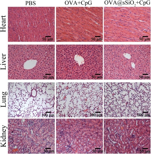 Figure 7 The section of mouse organs stained with hematoxylin and eosin (HE), the magnification of all the images was 40× except for the lung (20×).