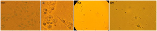 Figure 7. Representative pictures of MDA–MB-435 cells visualized on a light microscope (400× magnification) at 0 µM (A), 50 µM (B), 80 µM (C) and 100 µM (D) concentrations after 24 h.