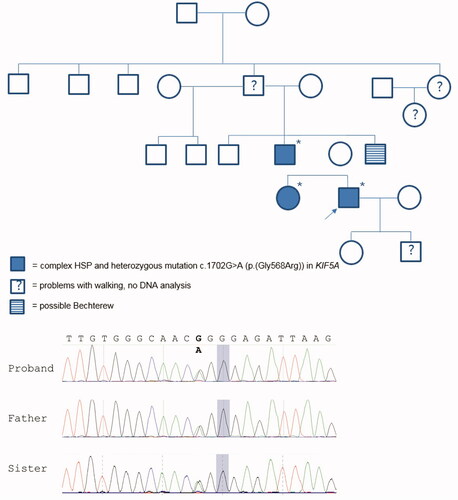 Figure 1 Pedigree of examined family including genotype/phenotype information. Females are represented by circles and males by squares. The proband is marked with an arrow and * indicates the cases that have a known genotype. Sequence chromatogram of proband, his father, and sister showing the c.1702G > A variant (bold).