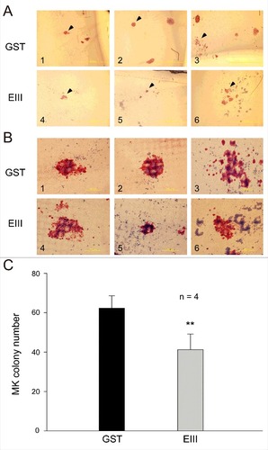 Figure 4. DENV-EIII suppressed megakaryopoiesis in the CFU-MK assay. Mononuclear cells isolated from human umbilical cord blood were used in the CFU-MK assay. The morphology (A–B) and quantitative numbers (C) of MK colonies after GST (A1–A3 and B1–B3) and DENV-EIII (A4–A6 and B4–B6) treatments are shown. Arrowheads indicating specific colonies in the low magnification images (A1–A6) are highlighted in the high magnification photographs (B1–B6). Scale bar: 2 mm (A), 200 μm (B). Data are presented as the mean ± SD and represent 4 independent experiments. ## P < 0.01 compared with the GST-treated groups