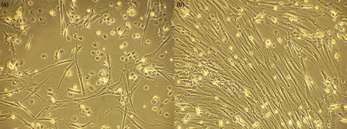 Figure 2 Spindle shaped MSCs (A) early in culture (day 10), (B) confluent MSCs, 10×.