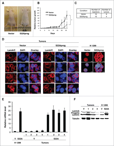Figure 7. S22A-progerin blocks tumor progression in mice. (A) Tumor formation in BALB/c nude mice injected with 106 H 1299 cells expressing vector or S22A-progerin (S22Aprog). (B) Relative tumor growth in BALB/c nude mice injected with H 1299 cells expressing a vector or S22A-progerin. * = p value <0.05. Error bars indicate SEM. (C) Summary of number of tumors developed in BALB/c nude mice. (D) Immunofluorescence for lamin A in tumor sections from mice inoculated with H 1299 cells expressing vector or S22A-progerin. Right panel shows the same staining in H 1299 cells before inoculation in mice. Magnification = 10 μm. (E) qPCR for LMNA (isoform A-delta50) in H 1299 cells expressing vector (V) of S22A-progerin (S22A) or from tumors as in (A). (F) Immunoblots for lamin A/C in tumors and H 1299 cells as in (A). Numbers indicate different tumors.