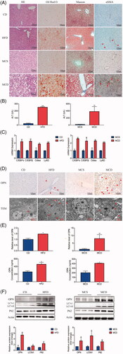 Figure 2. Increased expression of OPN with impaired autophagy in the livers of non-alcoholic fatty liver disease (NAFLD) animal models. Here we constructed two NAFLD models induced by high fat diet (HFD) and methionine-choline-deficient diet (MCD). The control groups were induced by chow diet (CD) and methionine-choline sufficient diet (MCS), respectively. (A) Representative images of H&E, Oil Red O, Masson and αSMA (brown) staining of liver tissue from NAFLD mice and controls (scale bars are shown). (B) Serum ALT levels were compared in NAFLD mice and controls. (C) The mRNA expression of lipogenic molecules in liver from NAFLD mice and controls. (D) The mRNA expression of OPN (brown, the scale bar indicates 100 μm, upper panel). Red arrows indicate autophagosomes, and red arrowheads indicate isolation membranes (lower panel). (E) Hepatic OPN expression measured by qRT-PCR and serum OPN concentration measured by ELISA. (F) The expression of OPN, LC3II and p62 was analyzed by Western blot. Scale bars are shown. Values are means ± SEM. *p < .05; **p < .01; ***p < .001. All experiments were repeated at least thrice.