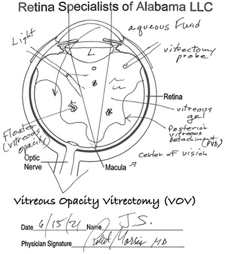 Figure 2 Drawing of the VOV operation created by Robert Morris, MD.