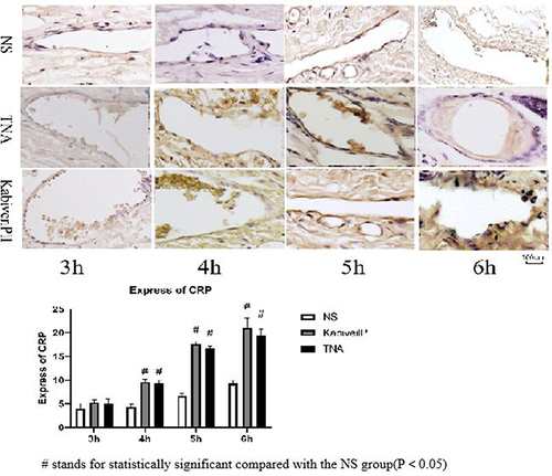 Figure 9 CRP at the tip of the indwelling needle.