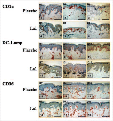 Figure 2 Representative immunohistochemical staining for three antigens, before treatment (BT) or on different days after UV exposure. Bars = 100 µm.