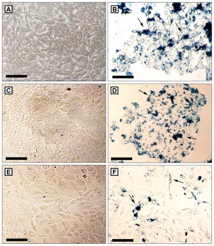 Figure 6 Perls staining of 4T1 (A and B), MCF-7 (C and D) and MCF-10A (E and F) after 48 hours without treatment (A, C and E) or after the treatment with 100 μL/mL of selol + 5 × 109 particles/mL (4X) (B, D and F).Notes: Clusters of magnetic nanoparticles are stained in blue. Higher amounts of pigment blue are visualized in neoplastic tumor cells. Bars indicate 100 μm.