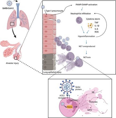 Figure 2. The hypothesis of how NETs lead to lung damage in COVID-19. First, SARS-CoV-2 infects the human airway epithelium via binding to ACE2 or TMPRSS2 receptors by invading type II pneumocytes. Insufficient PAMP/DAMP recognition is induced by viral evasion strategies and leads to inflammatory cytokine release. The inflammatory cytokines recruit neutrophils into viral-infected tissues in the lungs. The excessive inflammatory infiltration causes a cascade of cytokines (e.g. TNF-α, IL-6, IL-8), also called hyper-inflammation. Neutrophils involved in cytokine storm, on the other hand, lead to NET overproduction, represented by target proteins such as PAD4 as well as NE, priming the procedure of NETosis. Finally, the lung epithelium is injured by the processes of NETosis, reactive oxygen species, and myeloperoxidase overaction. The image was created with BioRender.com.