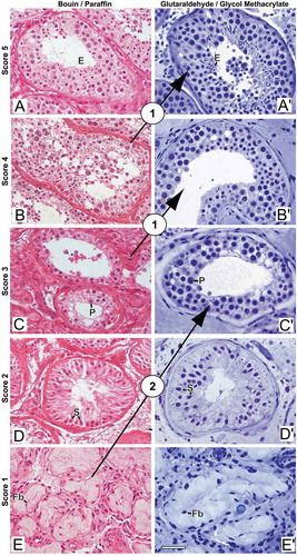 Figure 3. Photomicrographs illustrating changes in spermatogenesis scoring. (A-E) Bouin/paraffin (B/P) processing followed by hematoxylin & eosin staining. (A’-E’) Glutaraldehyde/glycol methacrylate (G/GMA) processing followed by toluidine blue-sodium borate staining. The arrows show diagnostic changes that occurred when samples initially scored with B/P were reevaluated with G/GMA. Numbers inside the circles represent the number of cases with diagnostic change after rescoring. P: pachytene spermatocyte; E: elongating spermatid; S: Sertoli cell; Fb: fibroblast. Bar: 50 μm