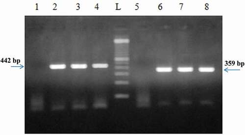 Figure 7. PCR product generated by D-loop and cytochrome b primers amplification of DNA extracted from brand 2 of turkey salami from swabs using NaOH extraction protocol and Phenol Chloroform Isoamyl alcohol protocol. P1→P4: D-loop primers, P5→P8: Cytochrome b primers, P1: negative control of D-loop primers protocol corresponding to Bardakci and Skibinski protocol with homogenization by a ball mill (vibro mill MM 400)., P5: negative control of cytochrome b primers, P2 and P6: NaOH extraction protocol (Protocol 1), P3 and P7: Phenol Choloroform Isoamyl alcohol extraction protocol1 (using 3.5 ml of the acqueous phase) (Protocol 2), P4 and P8: Phenol Choloroform Isoamyl alcohol extraction protocol1 (using the rest of the acqueous phase) (Protocol 3), L: 100 bp DNA ladder (Catalog Number: 15628019; thermoFisher Scientific).1Phenol Chloroform Isoamyl alcohol protocol corresponding to Bardakci and Skibinski protocol with homogenization by a ball mill (vibro mill MM 400).