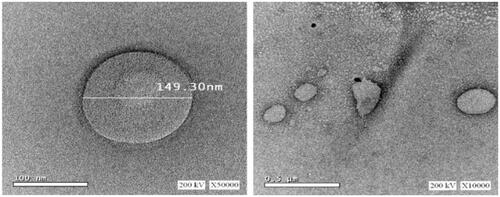 Figure 4. Morphology of MTD-SLNs obtained from batch SLN8. MTD, metronidazole; SLNs, solid lipid nanoparticles.