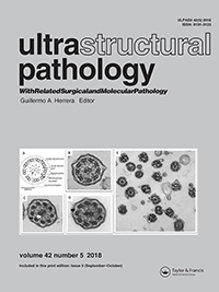 Cover image for Ultrastructural Pathology, Volume 42, Issue 5, 2018