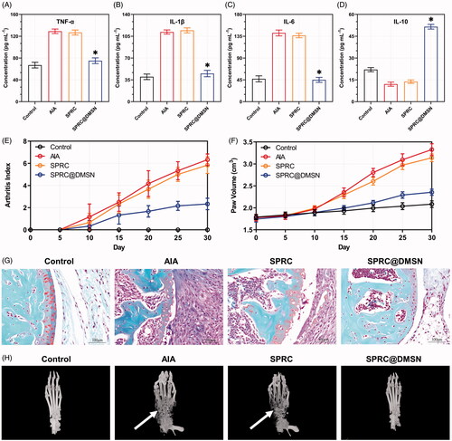 Figure 5. Supplementations mitigated AIA symptoms. The pro-inflammatory cytokines levels of (A) TNF-α, (B) IL-1β, and (C) IL-6 and anti-inflammatory cytokine level of (D) IL-10 in rats were measured. Significant different compared with AIA group indicated as (*) (n = 6, mean ± SD). (E) The arthritis index and (F) paw volume were used to evaluate the severity of swollen symptoms (n = 6, mean ± SD). (G) Safranin-O staining examination was conducted to evaluate the articular cartilage destruction. (Scale bar = 100 μm). (H) The micro 3 D analysis images of rats’ paws, 3 D reconstructions of paws from rats used the Mimics software. The erosions sites of bones indicated by the white arrow.