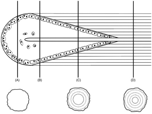 Figure 1. Coupled osteoclast and osteoblast activity depicted as a Basic Multicellular Unit (BMU) during bone remodelling. (A) Osteoclastic activity near the leading edge of the cutting cone, (B) initiation of osteoblastic activity, (C) active osteoblast activity, and (D) a fully formed intact osteon depicting a Haversian canal in the centre. Adapted from Pratt, with permission.