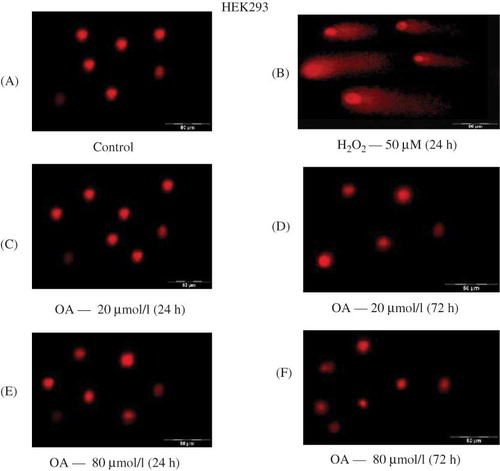 Figure 5. The effects of OA on DNA integrity of HEK293 cells in vitro after exposure to various concentrations of OA for 24 and 72 h. Control for 24 h (A), H2O2 — 50 μmol L−1 for 24 h (B), OA — 20 μmol L−1 for 24 h (C) and 72 h (D), and 80 μmol L−1 for 24 h (E) and 72 h (F).