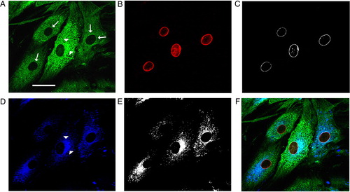 Figure 1. Glutathionylated proteins colocalized with the nuclear lamina, ER, and cytoskeleton. Immunofluorescence of glutathionylated proteins in human dermal fibroblasts (A) and multiple labeling with markers of the nuclear lamina (lamin B, in B) or rough ER (ConA pseudocolored in blue, in D), and their colocalization masks (C and E). GS-Pro was thickened around nuclei (arrows) and showed a strong colocalization with the nuclear lamina (white spots in C). The granular GS-Pro distribution was perinuclearly concentrated (arrowheads), interspersed in the cytoplasm, and significantly overlapped with the ER (colocalization mask in E, and merge signal in F). Scale bar, 40 µm.