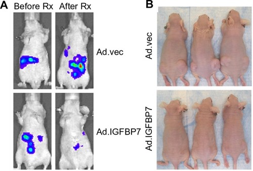 Figure 2 Ad.IGFBP7 is an effective therapy for hepatocellular carcinoma (HCC). (A) Bioluminescence imaging of nude mice with established orthotopic tumors in the liver using human HCC cells before (left) and after (right) treatment with Ad.IGFBP7. (B) Photograph of nude mice bearing subcutaneous xenografts from human HCC cells on both flanks treated with control Ad.vec (top) or Ad.IGFBP7 (bottom). Only the left-sided tumors were injected with Ad. Note the almost complete disappearance of both left- and right-sided tumors in Ad.IGFBP7-treated mice.